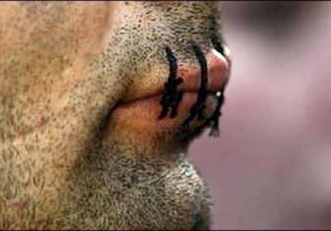 Ιταλία: Δεκατρείς μετανάστες έραψαν τα στόματά τους - Media