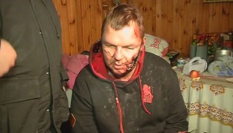 Ουκρανία: Βασανισμένος και σε κατ’ οίκον περιορισμό… - Media