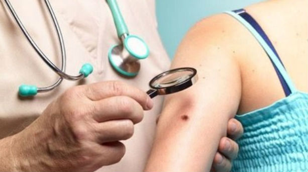 Εξεταστείτε δωρεάν για τον καρκίνο του δέρματος από 5 έως 9 Μαΐου - Media