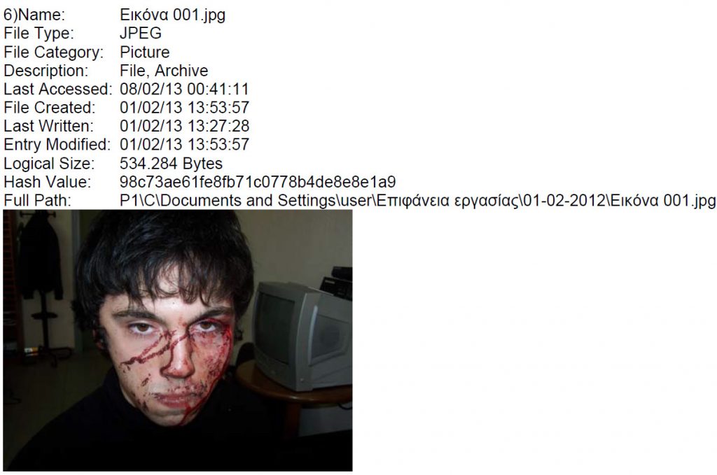 Σοκαριστικές φωτογραφίες των τραυματισμένων συλληφθέντων του Βελβεντού - Media