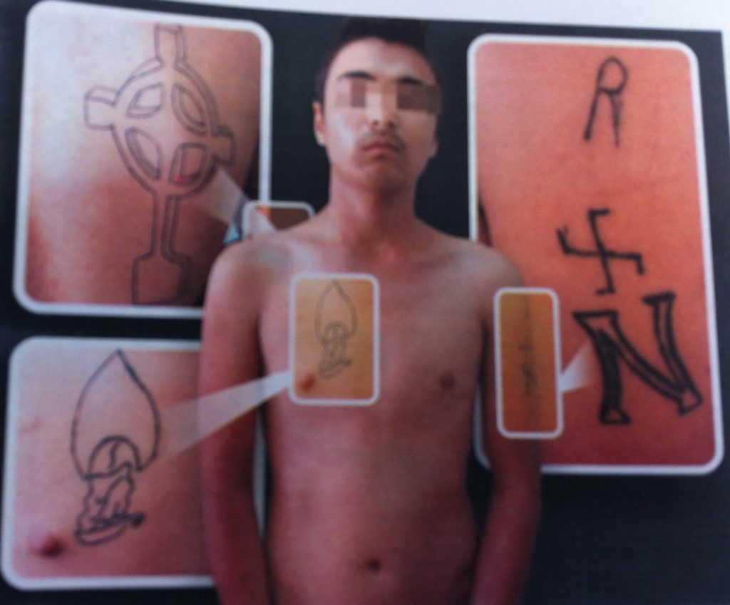 Τατουάζ με τη σβάστικα έχει ο Αφγανός που επιτέθηκε σε φοιτήτρια στην Κέρκυρα - Media