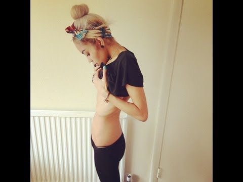 Αυτή η γυναίκα ήταν στον 8ο μήνα και ζύγιζε… 50 κιλά (photo) - Media