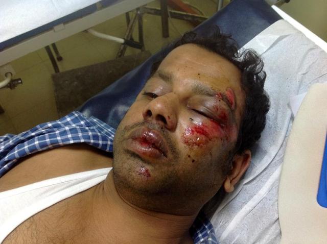 Επίθεση με καδρόνια σε μετανάστες στην Καλλιθέα - Media