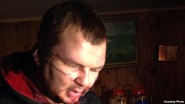 Ουκρανός ακτιβιστής καταγγέλει βασανιστήρια - Media