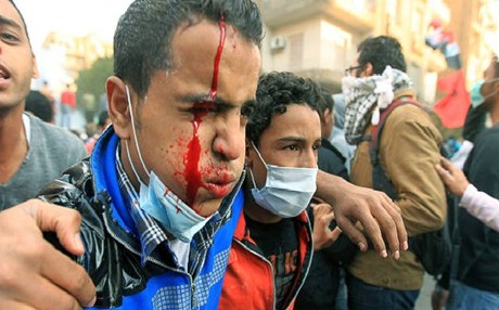 Αίγυπτος: Χειρουργούν χωρίς αναισθησία διαδηλωτές! - Media