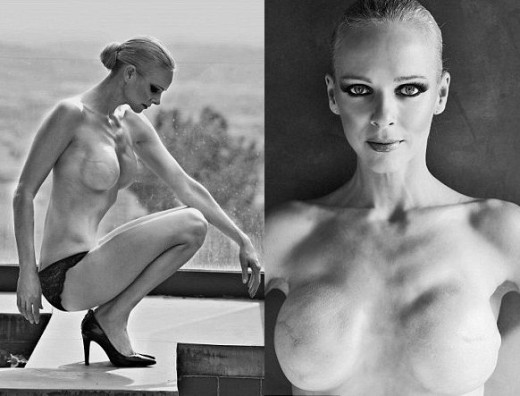 Γυμνή φωτογράφιση της Claire Farwell μετά από διπλή μαστεκτομή - Media