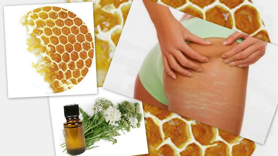 Φυσική κρέμα που «εξολοθρεύει» τις ραγάδες - Media