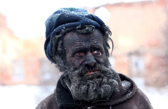 Ο πιο βρώμικος άνθρωπος του κόσμου ζει μέσα στις στάχτες (Photos) - Media