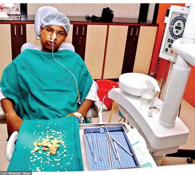 Απίστευτο: Του αφαίρεσαν 232 δόντια από το στόμα (Photos&Video) - Media