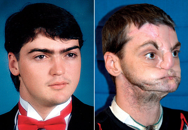 Οι 5 πιο απίστευτες επεμβάσεις επανορθωτικής προσώπου - Media