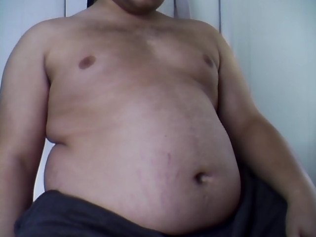 Ένα συγκλονιστικό βίντεο για την παχυσαρκία- Μπορεί να συμβεί στον καθένα - Media