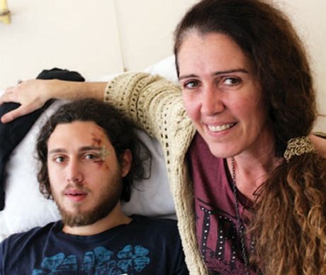 Τι λέει ο φοιτητής που ξυλοκοπήθηκε στην Κομοτηνή - Media