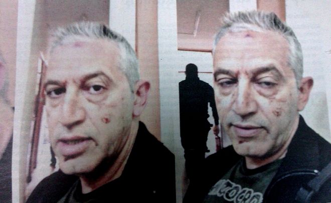 Πολίτης καταγγέλλει ξυλοδαρμό στο Μετρό για ένα εισιτήριο! - Media