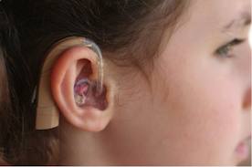 Η κώφωση θεραπεύεται μέσα στα δυο πρώτα χρόνια της ζωής - Media