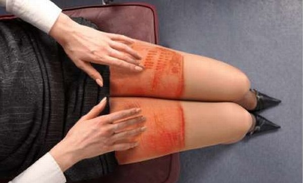 Μην ακουμπάτε το laptop στα πόδια σας - Δείτε τι μπορεί να πάθετε (ΦΩΤΟ) - Media