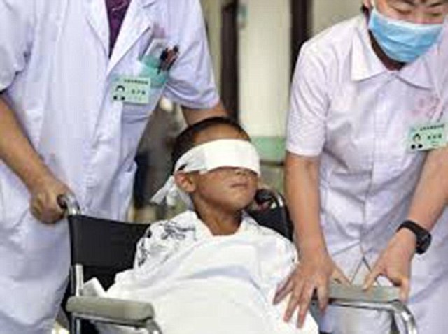 Έβγαλε τα μάτια του γιου της με κουτάλι - Media