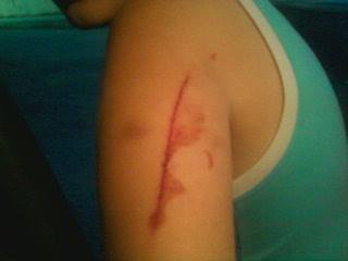 Πάτρα: Καταγγέλλει ότι αστυνομικός χτύπησε το 10χρονο παιδί της! - Media