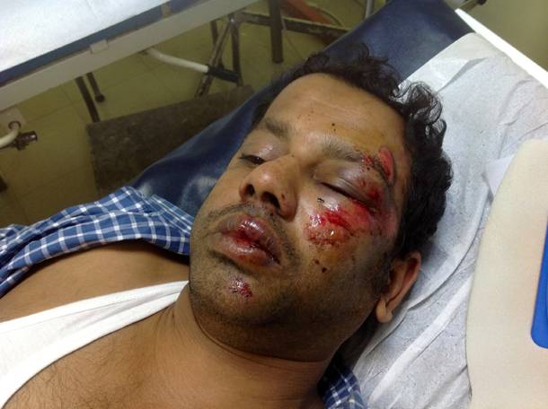 Τουλάχιστον 320 τα θύματα ρατσιστικής βίας το 2013 στην Ελλάδα - Media