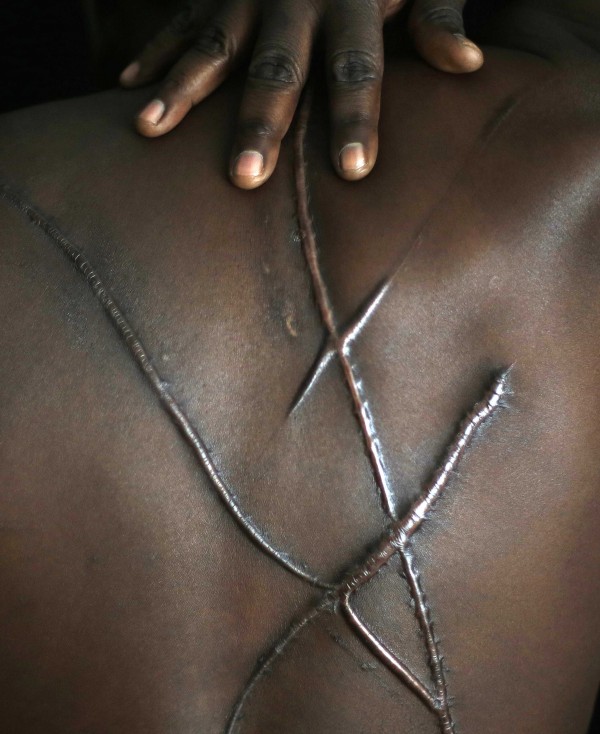 Reuters: Βασανισμοί μεταναστών στην Ελλάδα - Media