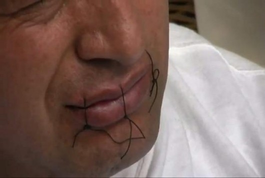 Έραψαν το στόμα τους τέσσερις μετανάστες στην Ιταλία - Media