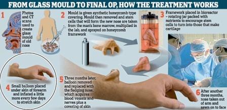 Μια μύτη μεγαλώνει… στο χέρι του! - Media