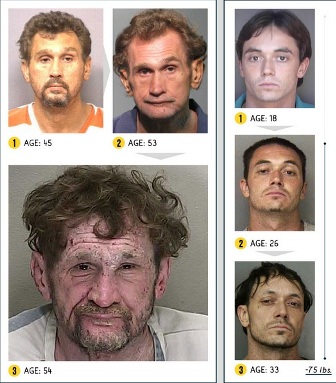 Έτσι γίνεται κάποιος ύστερα από ολιγόμηνη χρήση ναρκωτικών (Συγκλονιστικές φωτό) - Media