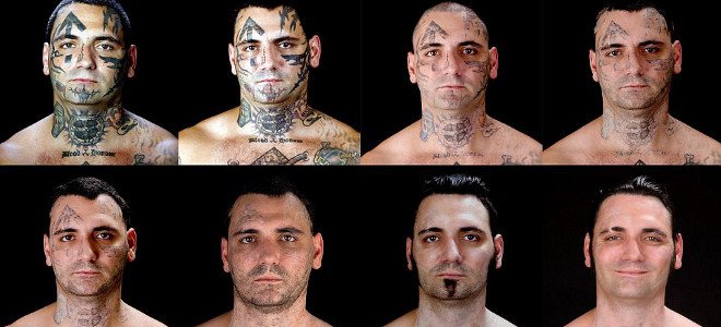 Μετανιωμένος ρατσιστής αφαιρεί όλα τα ναζιστικά τατουάζ (Video) - Media