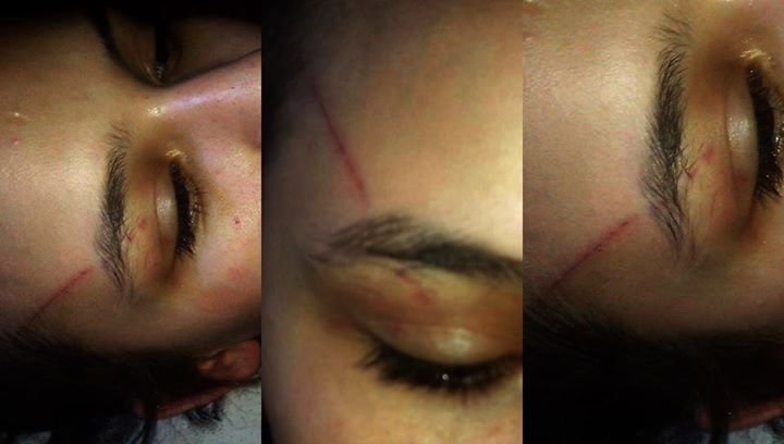 Ομοφοβική επίθεση σε βάρος της καταγγέλλει 17χρονη - Media