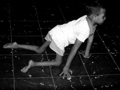 Περίεργη ασθένεια χτυπάει και παραλύει τα παιδιά στις ΗΠΑ - Media