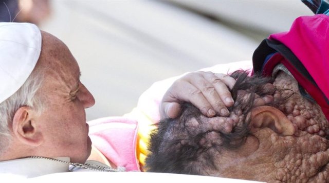 Το φιλί του Πάπα σε έναν παραμορφωμένο  
 - Media