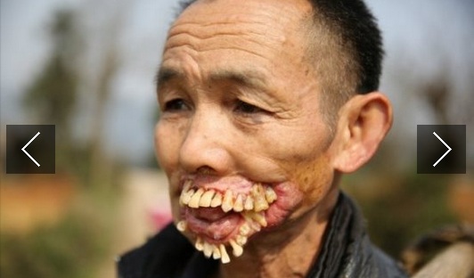 Αυτές είναι οι 12 πιο παράξενες και σπάνιες ασθένειες στη γη (Photos) - Media