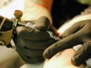 «Χτυπάει» τατουάζ το ονοματεπώνυμο σε ασθενείς με Αλτσχάιμερ 
 - Media