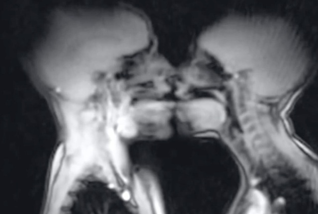 Δείτε ένα ζευγάρι να κάνει σεξ και να καταγράφεται από μαγνητικό τομογράφο - Media