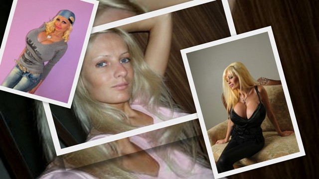 Πως ήταν και πως έγινε, μετά από πλαστικές επεμβάσεις (Photo) - Media