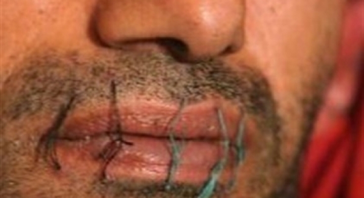 Έραψαν τα χείλη τους για να μην απελαθούν από το νησί Ναουρού! - Media