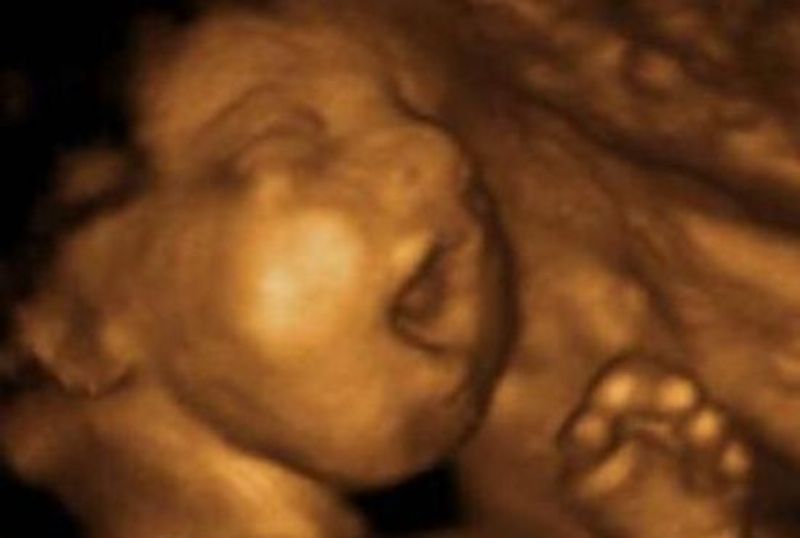 Συγκλονιστικό: Δείτε τι κάνει ένα μωρό μέσα στην κοιλιά μιας μητέρας- καπνίστριας - Media