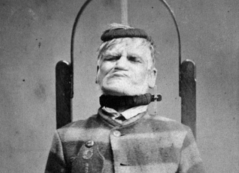 Δείτε φωτογραφίες ασθενών σε ψυχιατρικό άσυλο του 1800 - Media