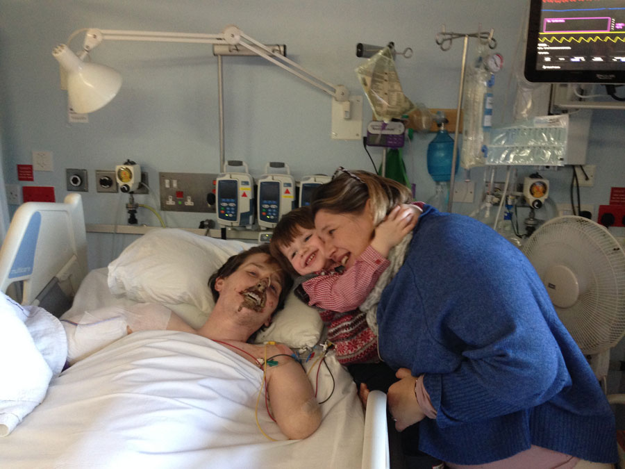 Είχε μόνο 3 στις 100 πιθανότητες να ζήσει- σάπισαν τα χείλη του, έχασε χέρια και πόδια - Media