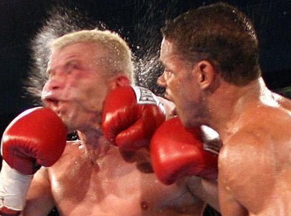 Πως τα χτυπήματα στο κεφάλι μικραίνουν τον εγκέφαλο - Media