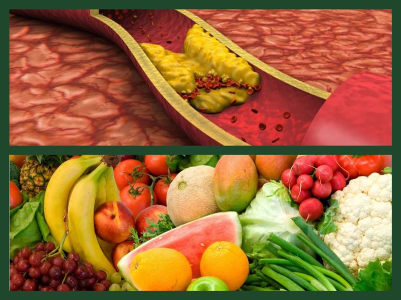 Ποια φυσική τροφή «ρίχνει» εύκολα τη χοληστερίνη, όπως οι στατίνες; - Media