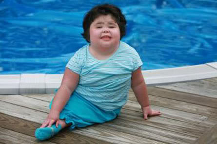 Η ζωή και ο θάνατος του κοριτσιού που δεν είχε πόδια, αλλά πτερύγιο γοργόνας (Video) - Media