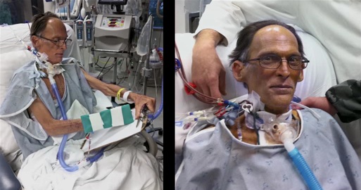 Ο άνθρωπος που έζησε με μια καρδιά που δεν χτυπούσε (Video) - Media