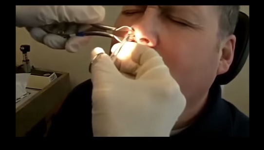 Και όμως αυτό το πράγμα υπήρχε μέσα στη μύτη του (Video) - Media