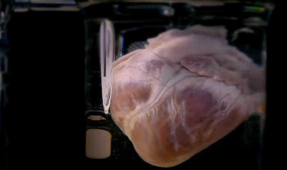 Δείτε τη δημιουργία από το μηδέν, μιας καρδιάς από βλαστοκύτταρα (VIDEO) - Media