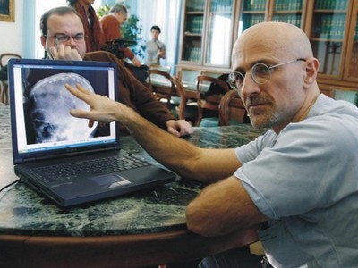 Στα χνάρια του… Φρανκενστάιν – Ιταλός χειρούργος θέλει να πραγματοποιήσει την πρώτη μεταμόσχευση ανθρώπινου κεφαλιού! - Media