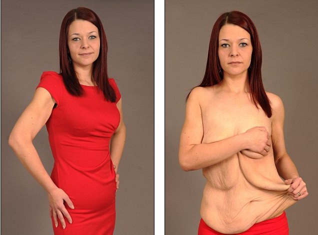 Έχασε κιλά και όμως καταστράφηκε η σεξουαλική της ζωή - Τι συνέβη; (Photos) - Media