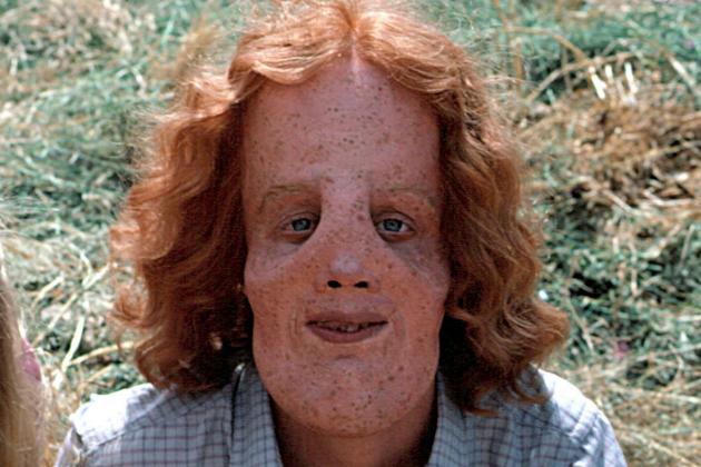 Διαβάστε την εκπληκτική ιστορία του «ανθρώπου με τη μάσκα» - Media