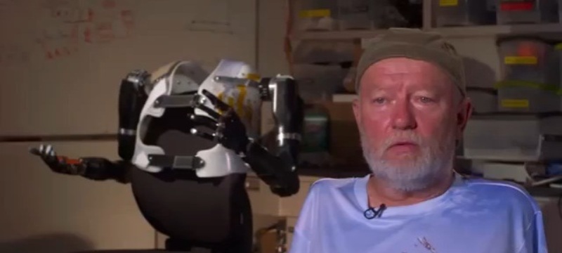 Ανάπηρος ελέγχει με τη σκέψη του τα τεχνητά μέλη! (Video) - Media