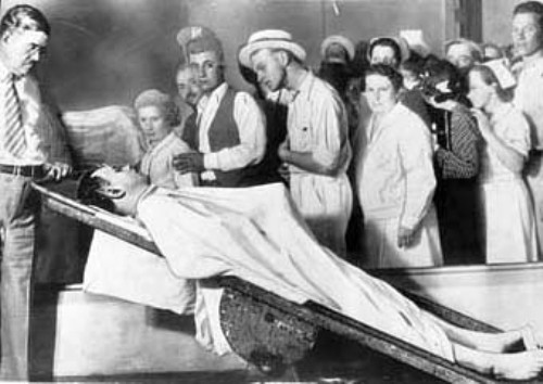 Τι είναι η στύση του θανάτου; Ποιες λειτουργίες του σώματος συνεχίζουν, ακόμη και μετά θάνατον - Media