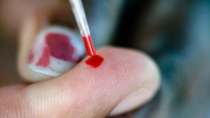 Βρετανία: Πωλούνται μέσω διαδικτύου τεστ αυτοδιάγνωσης του AIDS! - Media